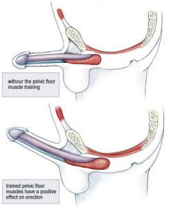 Exercise for kegel man www Kegel Exercise